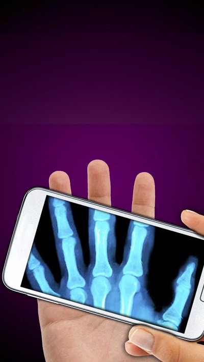 X射线模拟器-手机X光整蛊 X射线模拟器手机版下载